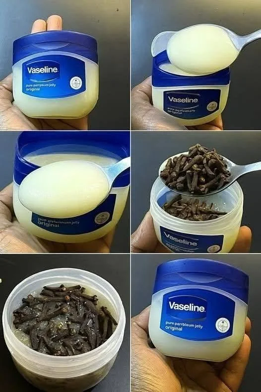 Homemade clove salve made with clove oil and petroleum jelly for natural healing.