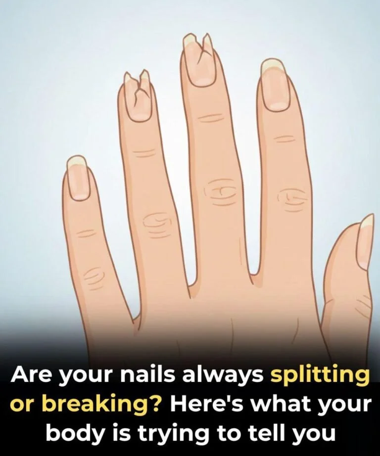 Illustration of unhealthy nails indicating the need for a check-up on nail health.