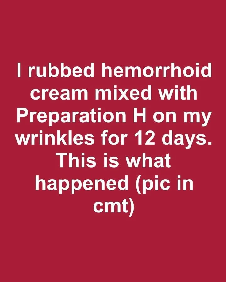 Before and after results of using Preparation H on wrinkles.