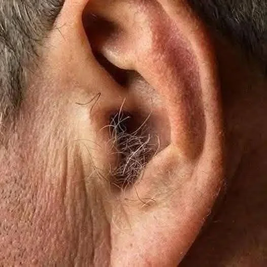 Diagram explaining the reasons for ear hair growth in the human body.